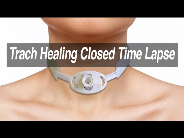 Tracheostomy Healing Closed Time Lapse