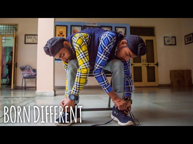 We're 19 And Conjoined Twins - But Happy To Be Together | BORN DIFFERENT