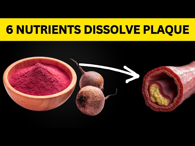 6 Powerful Nutrients That Help Clear Arterial Plaque (Backed by Science!)