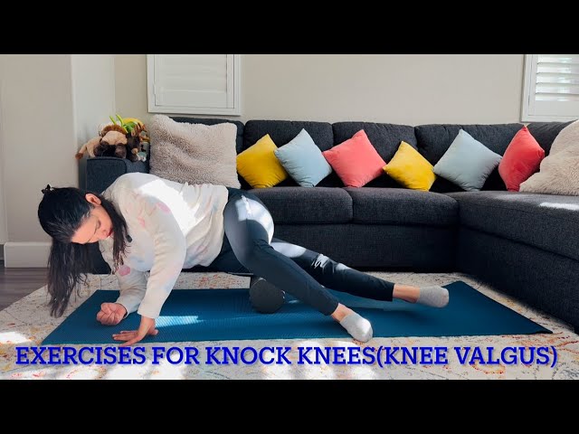 Knock Knee Exercises(Knee Valgus): Stretch & Strengthen