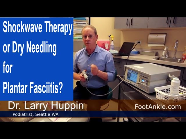 Shockwave Therapy or Dry Needling for Plantar Fasciitis? | Seattle Podiatrist