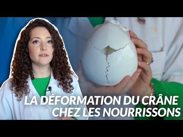 La déformation du crâne chez les nourrissons