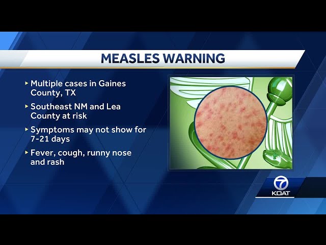 Health officials warn of measles exposure after cases found in Texas