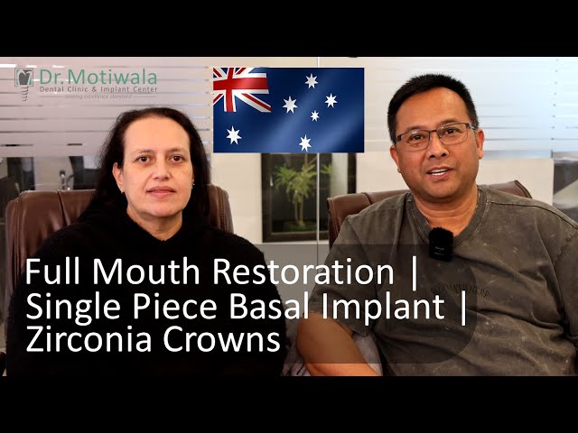 Full Mouth Restoration Experience in India | Testimonial | Immediate Loading of Dental Implants