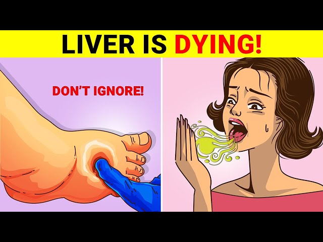 16 Warning Signs Your Liver Is Failing | When to Seek Help Immediately