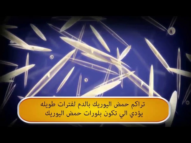 مرض النقرس أسبابة و أعراضه و طرق علاجه