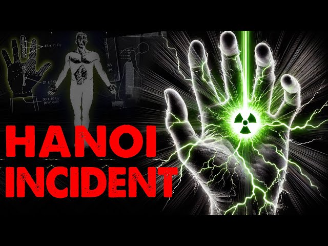 Hand vs. Particle Accelerator: A Lethal Radiation Exposure (Documentary)