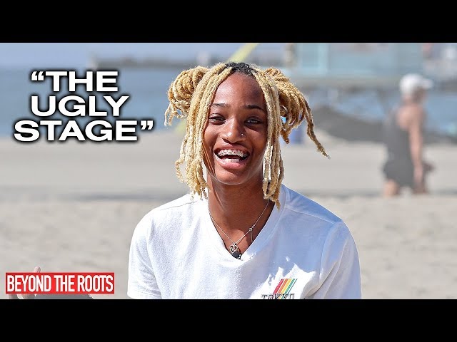 The Ugly Stage of Dreadlocks - Beyond The Roots #004