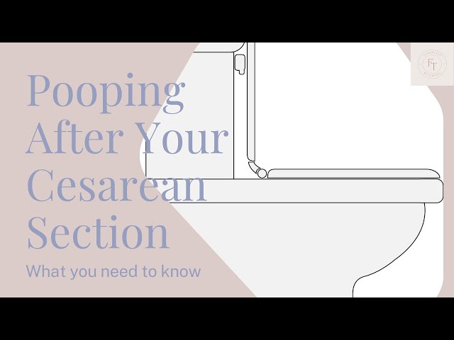 Pooping after a Cesarean Section