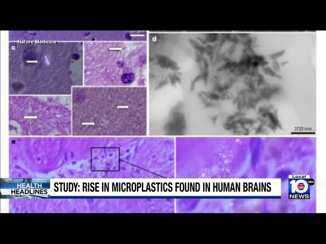 Study: Microplastics are making their way into humans’ bodies, even reaching the brain