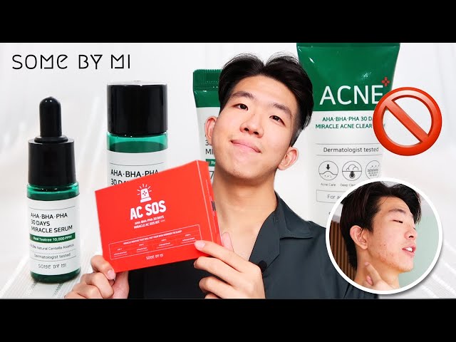 Never again! SOMEBYMI Acne Review | WORST Skin reaction! • AHA BHA PHA