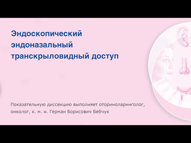 Эндоскопический эндоназальный транскрыловидный доступ выполняет Герман Борисович Бебчук