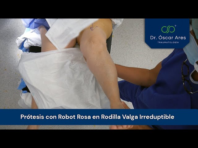 Prótesis con Robot Rosa en Rodilla Valga Irreduptible - Dr. Oscar Ares