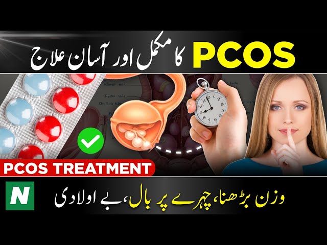 PCOS Complete Solution ✅ How To Treat PCOS Easily | Pcos ka ilaj | Pcos Symptoms