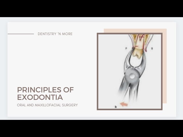 PRINCIPLES OF EXODONTIA