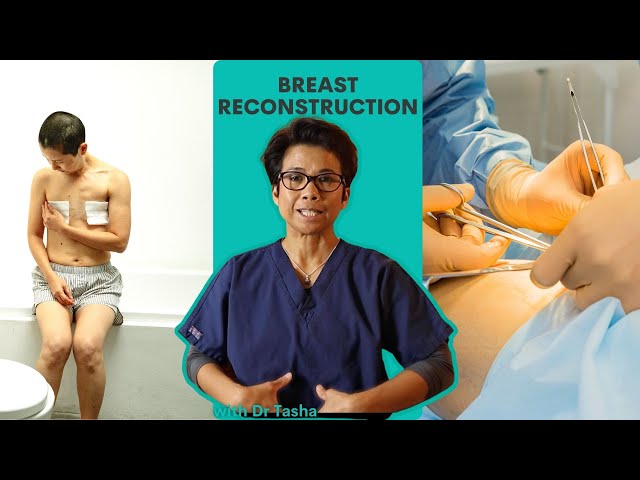 What Are Your Breast Reconstruction Options? with Dr Tasha