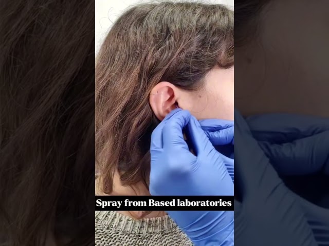 Daith Piercing Aftercare | Pro Tips! With Base Labs Hypochlorous Acid Spray