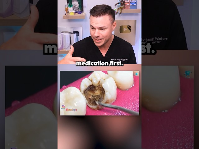 Dentist Reveals What REALLY Happens In A Root Canal! 😭🦷