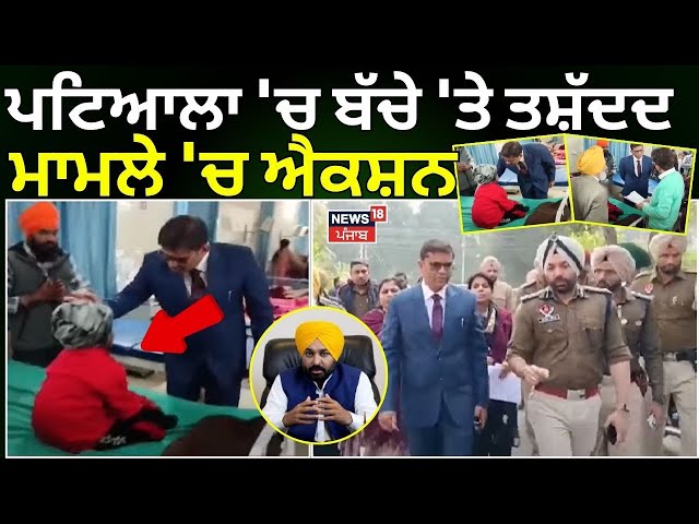 Patiala News | ਪਟਿਆਲਾ 'ਚ ਬੱਚੇ 'ਤੇ ਤਸ਼ੱਦਦ ਮਾਮਲੇ 'ਚ ਐਕਸ਼ਨ | Breaking News | Punjab News | News18 Punjab