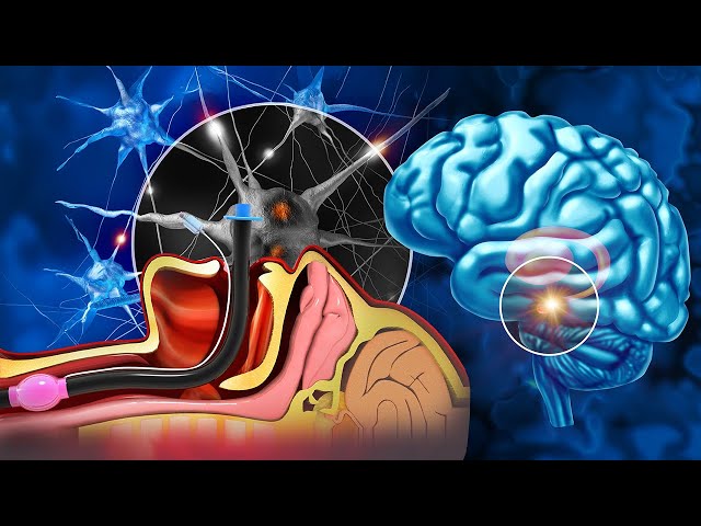 (WARNING:VERY POWERFUL!) Brain Massage: Complete Body Restoration, Your Body Will Have Clear Change