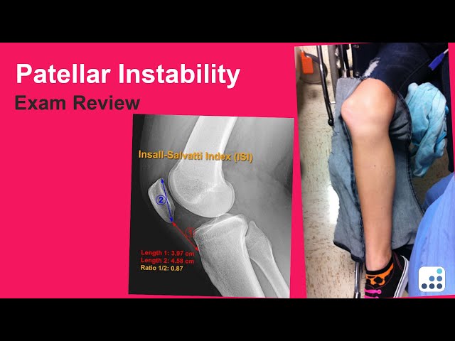 Patellar Instability Exam Review - C. Lowry Barnes, MD