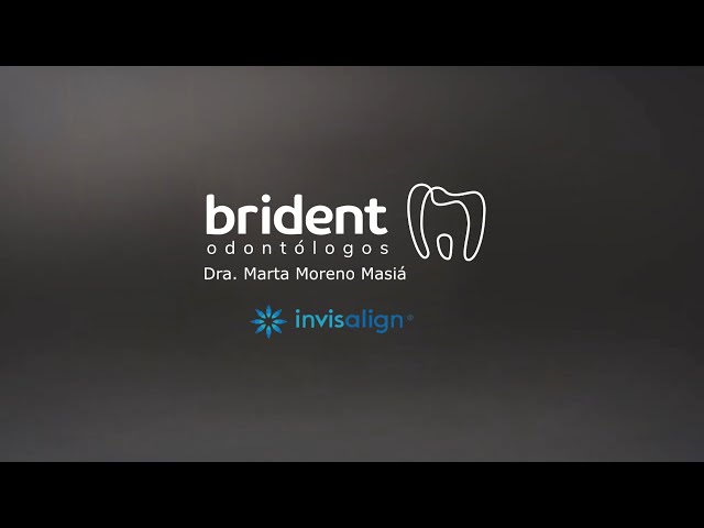 ORTODONCIA INVISIBLE INVISALIGN - Apiñamiento severo