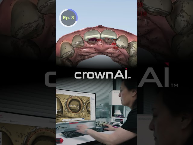 Milling a ZIRCONIA Crown in 35 MINUTES ! #dentalshorts