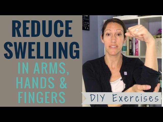 DIY Upper Extremity Lymphedema Exercises for Swollen Arms, Hands and Fingers