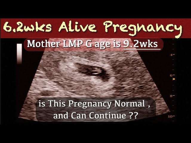 6+ wks Early Pregnancy Ultrasound - Mother LMP G Age is 9+wks | is this Normal ??