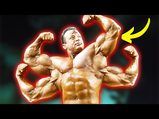 7 People With Extra Body Parts You Won't Believe Exist