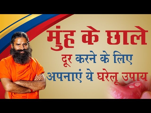 मुंह के छाले दूर करने के लिए अपनाएं ये घरेलू उपाय | Swami Ramdev