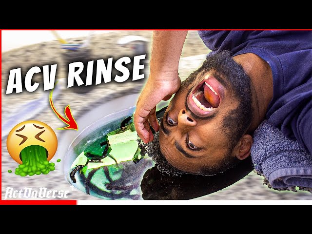 NASTY ACV Rinse On 2 Years Dreadlocks pt.2 - PREPARING TO DYE MY HAIR A NEW COLOR