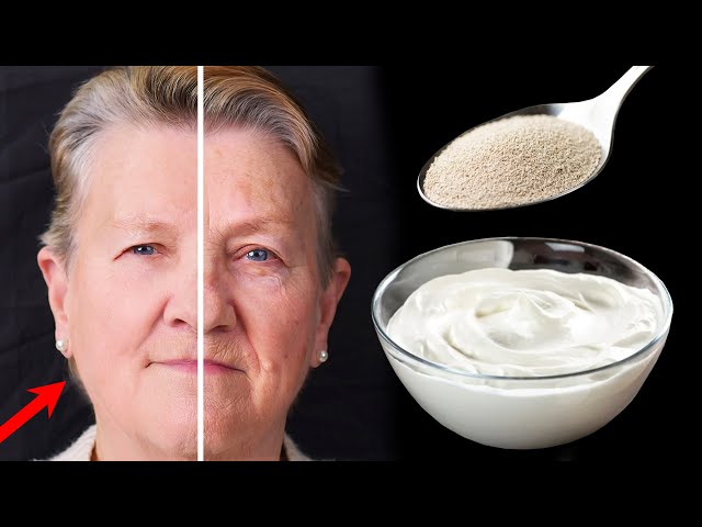 Mix yogurt with yeast. It removes all wrinkles in 10 minutes. Even my 70-year-old granny