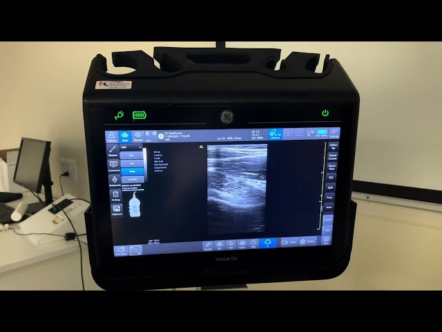 MSK Ultrasound - Hip - Anterior soft tissues