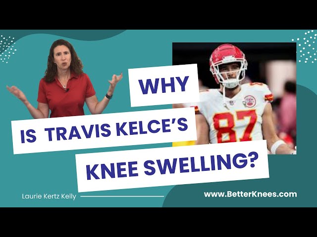 Why is Travis Kelce’s knee swelling? And how his injury can help your knees.