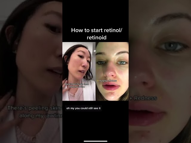 How to start Retinol/Retinoids #shorts