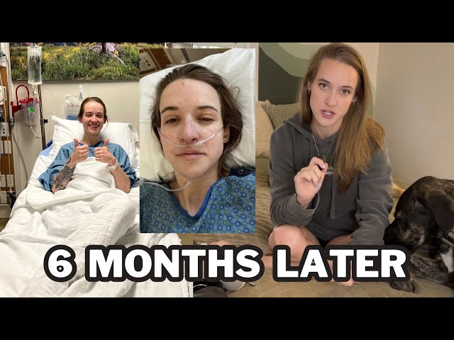 My amputation surgery failed...again