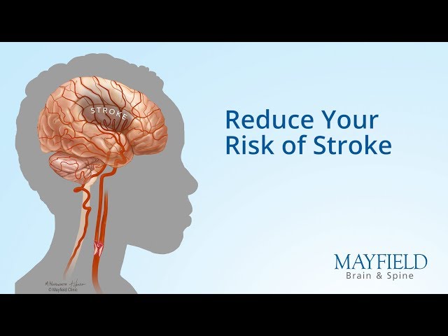 Reduce Your Risk of Stroke