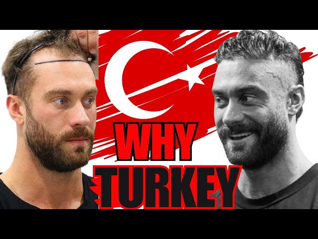 Why is Turkey So Popular For Hair Transplants?