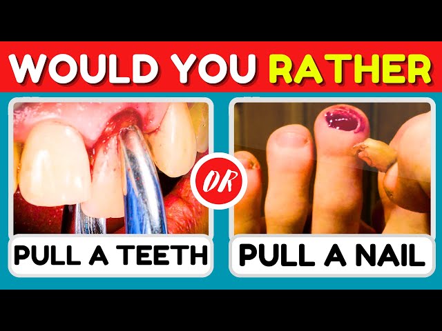 Would You Rather HARDEST Choices Ever (Impossible Level ! 😱😲)