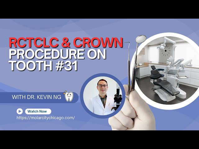 Transformative RCTCLC & Crown Procedure on Tooth #31 – A Must-See Dental Restoration!