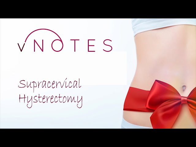 vNOTES Supracervical Hysterectomy