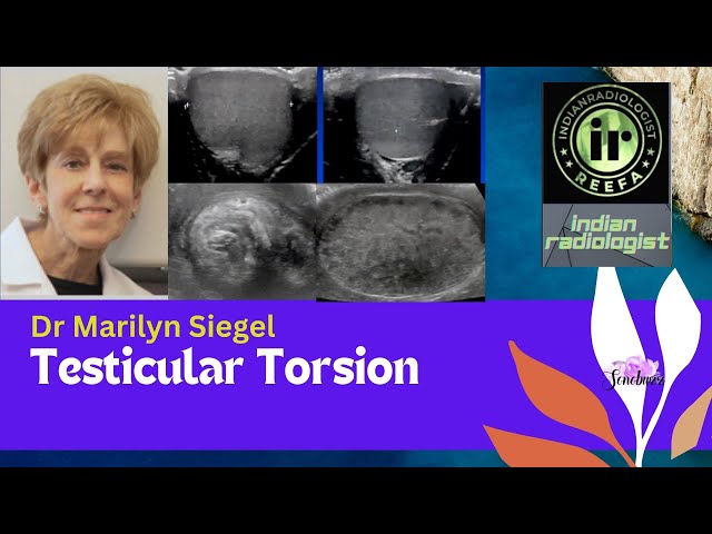 Dr Marilyn Siegel   Testicular Torsion- USG & Color Doppler | scrotal pain