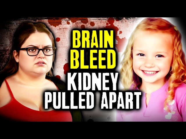 Mom Bashes Daughter's Head Until Her Brain Ruptures