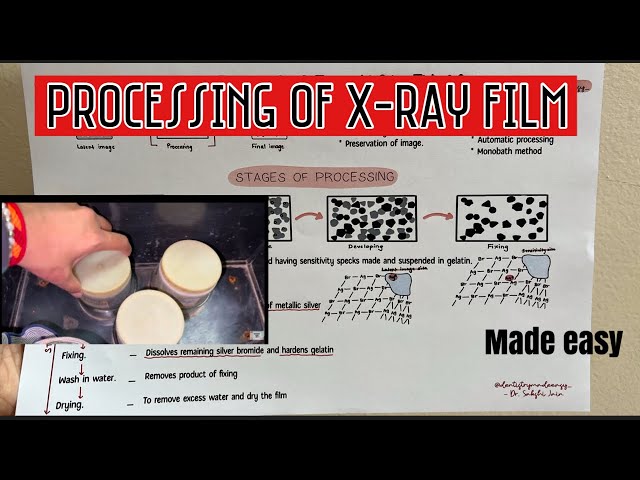 PROCESSING OF X-RAY FILM || ORAL RADIOLOGY