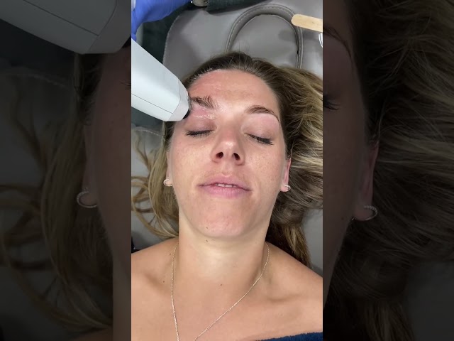 Doctor explains how to get a Non-Surgical Face Lift at Dr. Medispa