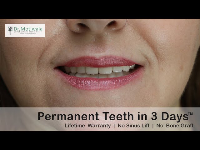 Sophie from, USA relates her experience of full mouth dental implants in India | Perfect Dentist