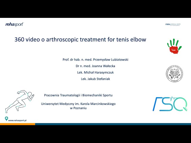 360 video of arthroscopic treatment for tennis elbow