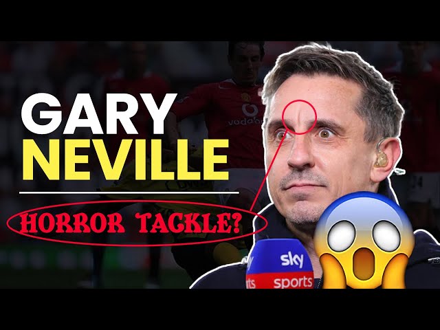 Gary Neville’s Forehead Scar: How Did He Get the Scar on His Head?