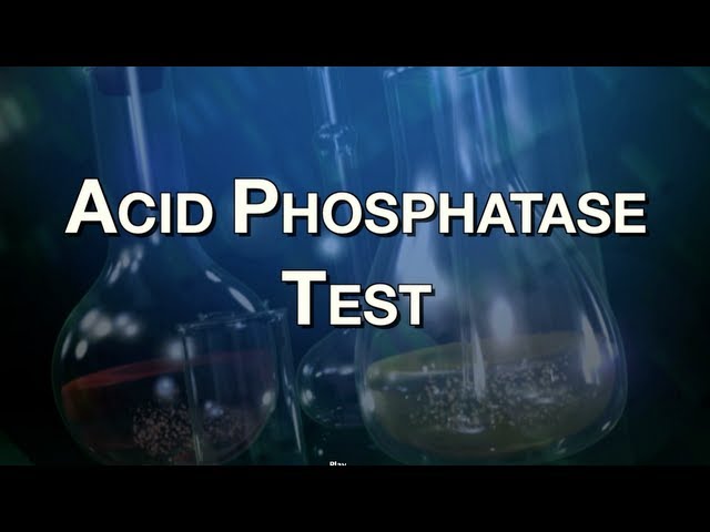 Acid Phosphatase Test